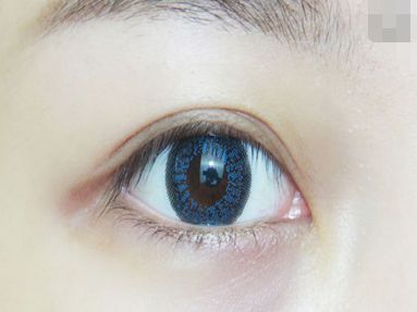 長沙眼部皺紋整形醫(yī)院排行榜及口碑測評(píng)