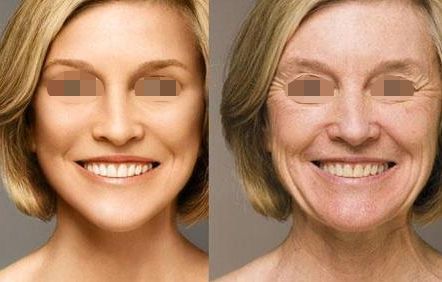 無錫果酸換膚美白醫(yī)院排名前10公布！