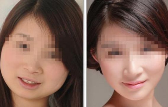 長(zhǎng)沙小切口除眉間皺紋醫(yī)院推薦10強(qiáng)榜單，助您煥發(fā)青春光彩！