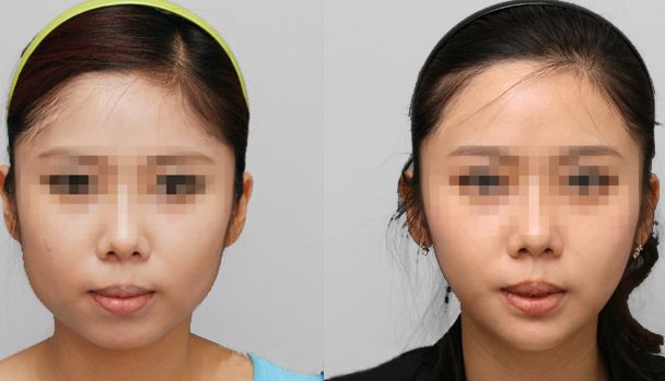 哈爾濱去毛孔好口碑醫(yī)院大揭秘！前十實力榜單不容錯過