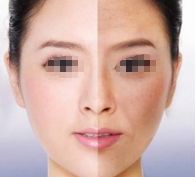 溫州玻尿酸祛斑｜值得信賴的10家美容機構(gòu)推薦