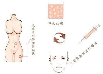 西安面部激光祛斑美容醫(yī)院口碑十強(qiáng)排行