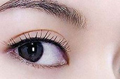 專業(yè)東莞微整形醫(yī)院推薦：根除生長紋