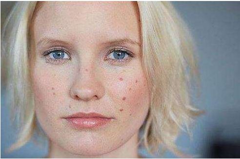 長(zhǎng)沙面部填充手術(shù)哪家醫(yī)院好？十大整形醫(yī)院綜合排名大揭秘