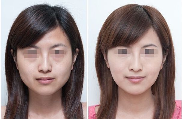 北京瘦腰美容醫(yī)院權(quán)威榜單，為你揭曉美體塑形圣地！