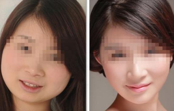 北京隆胸整容醫(yī)院哪家好？