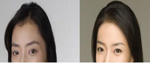 揭秘！鄭州十佳妙手雕刻川字紋修復(fù)容顏