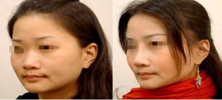 廈門哪家醫(yī)院做隆胸好？醫(yī)院排名前十！名單及技術(shù)特色詳解！點(diǎn)擊查看