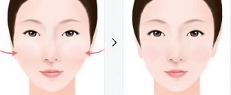 長(zhǎng)沙除皺針祛眼角皺紋醫(yī)院推薦：專(zhuān)業(yè)機(jī)構(gòu)選擇指南