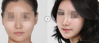 長(zhǎng)春彩光祛斑醫(yī)美機(jī)構(gòu)推薦：預(yù)約掛號(hào)指南