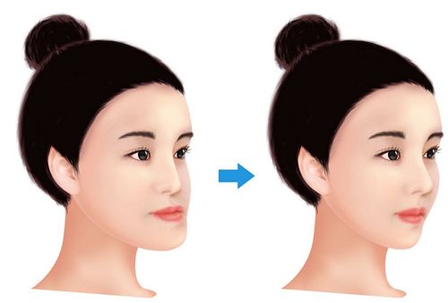 重慶哪家豐胸醫(yī)院好？時光、美萊、藝星等靠譜！