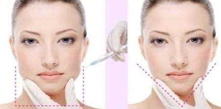 韓國(guó)整容價(jià)格清單：面部、胸部異物手術(shù)費(fèi)用對(duì)比