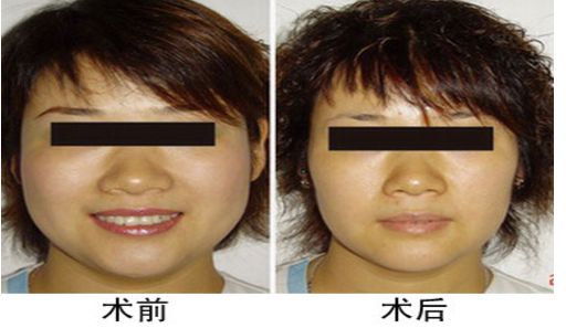 寧波E光祛痘醫(yī)院排名前10大機(jī)構(gòu)匯總