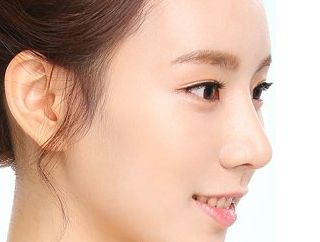 常州施爾美隆胸手術(shù)效果評價如何？