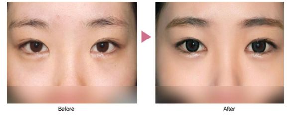 武漢五維祛痘醫(yī)院口碑實(shí)力大盤(pán)點(diǎn)，助你輕松祛痘煥新顔