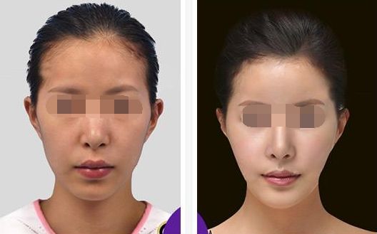 【2024年最新】濟(jì)寧祛痘前十整形美容醫(yī)院排行榜大揭秘！