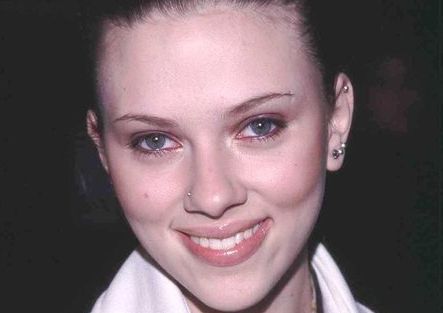 無錫哪家整形醫(yī)院治療疤痕效果好？專家排名解析