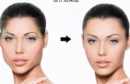 上海無(wú)創(chuàng)線雕美容醫(yī)院推薦：前十名詳解