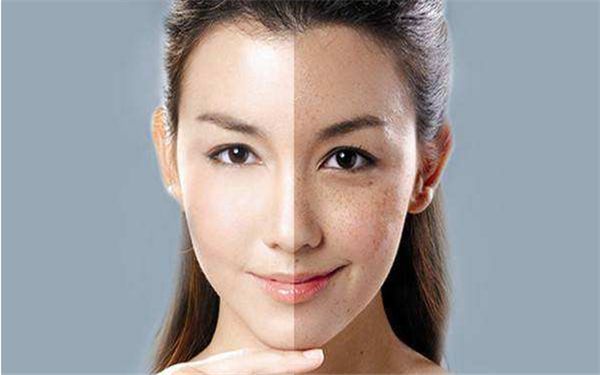 天津川字紋非手術(shù)去除十佳醫(yī)院榜單出爐