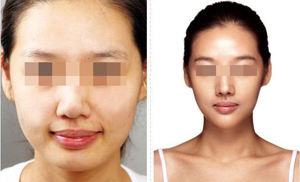 洛陽眼周細(xì)紋去除，十家整形醫(yī)院評(píng)測(cè)