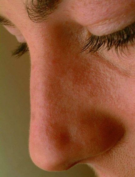 上海各正畸美容醫(yī)院口碑指南：下巴后縮矯正專業(yè)機構大比拼