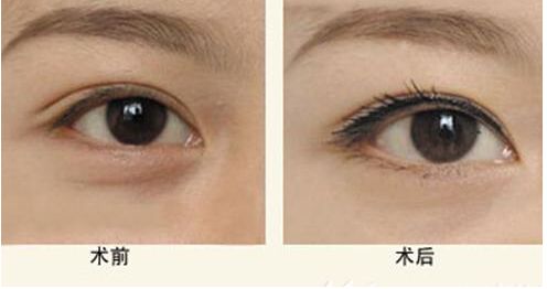 重慶哪家整容醫(yī)院做磨骨手術(shù)口碑好？整理10家專業(yè)醫(yī)院供參考！