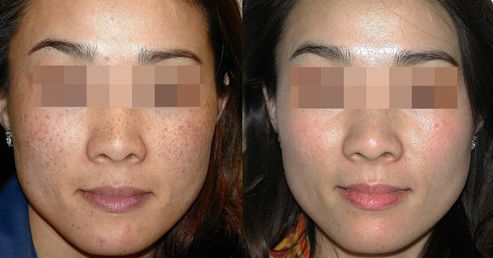 南昌口碑鼻整形醫(yī)院TOP10強(qiáng)勢(shì)盤點(diǎn)！