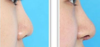 安徽醫(yī)科大學第四附屬醫(yī)院燒傷整形科費用解析