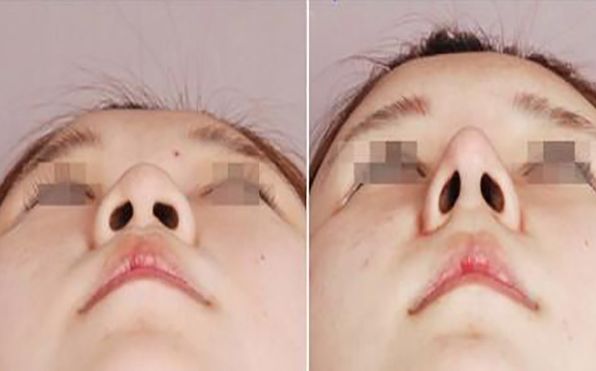 寧波botox除皺綜合實(shí)力TOP10整形美容機(jī)構(gòu)盤(pán)點(diǎn)