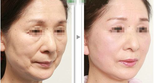 濟南玻尿酸胸部填充美容醫(yī)院排名TOP10，口碑好評精選！