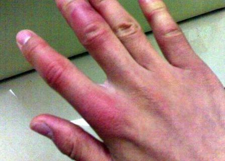 中山微雕祛動(dòng)態(tài)細(xì)紋TOP10實(shí)力整形醫(yī)院推薦榜