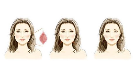 金華市有哪些好的開眼角整形醫(yī)院？當(dāng)?shù)赝七x的醫(yī)美榜單【必看】！