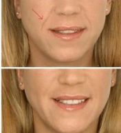 沈陽最具口碑的整形醫(yī)院推薦：前十名排名