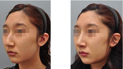 成都肉毒素抗皺權(quán)威榜單，十家口碑醫(yī)院大解密