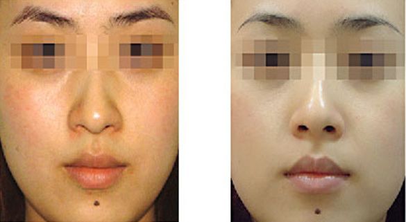 東莞眼角紋治療醫(yī)院排名TOP10，專(zhuān)業(yè)細(xì)胞活化美容醫(yī)院推薦！