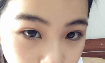 上海哪家整形醫(yī)院有優(yōu)秀的激光除皺技術(shù)？