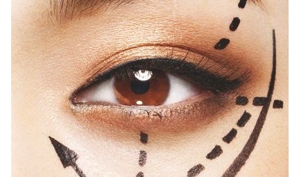 臺(tái)州魚(yú)尾紋治療推薦TOP10整形醫(yī)院大揭秘！