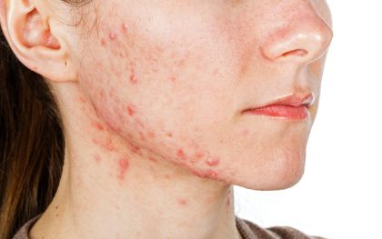 大連立光康復(fù)醫(yī)院整形價(jià)格表及醫(yī)生資料詳解！