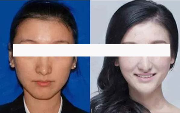 南京隆眉弓醫(yī)院口碑精選排行榜