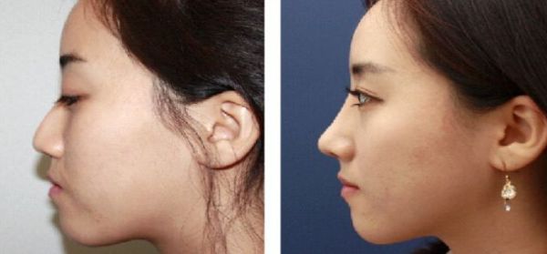 蘇州彩光美容整形醫(yī)院排名前10的技術(shù)優(yōu)勢(shì)解析