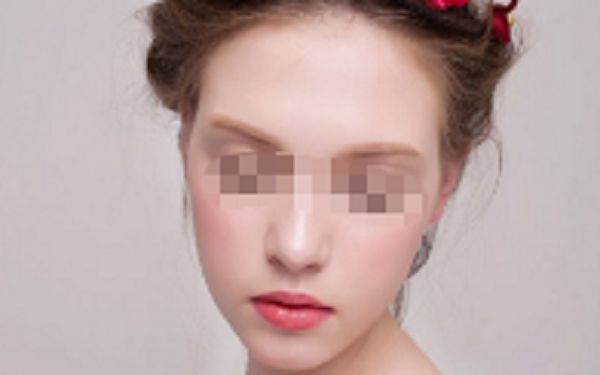 北京川字紋激光去除：十強整形醫(yī)院技術(shù)一覽