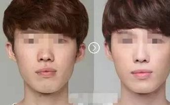 臨沂乳房下垂懸吊口碑好技術(shù)精湛的前十家美容醫(yī)院