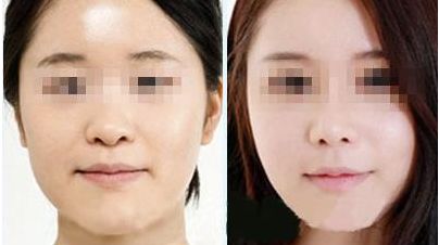 云南眼周細(xì)紋治療醫(yī)院排名前10大揭秘！