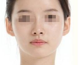 濰坊頸紋祛除醫(yī)院排行榜TOP10，實(shí)力口碑大盤點(diǎn)！