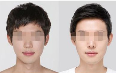 金華全身脫毛最佳醫(yī)院排行榜TOP10，專家推薦！