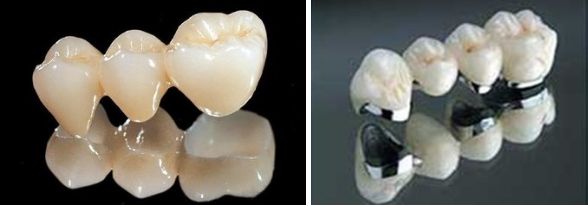 廈門微針痘坑治療推薦前十醫(yī)院，免費咨詢！