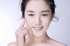 舟山眼角紋注射填充：全國10家正規(guī)整形醫(yī)院推薦