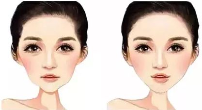 北京八大處雙眼皮掛什么科，怎樣專業(yè)修復(fù)雙眼皮問題？相關(guān)專家分享及病例反饋