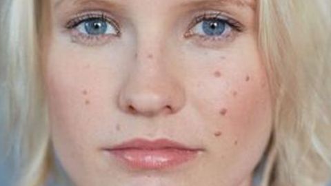 成都華人醫(yī)聯(lián)整形醫(yī)院用戶口碑及醫(yī)生推薦評(píng)測(cè)