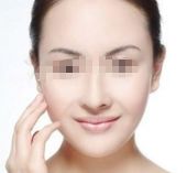 蘇州黃金微針去疤口碑排行：前10家權(quán)威整形醫(yī)院大盤點